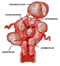 Types of uterine fibroids