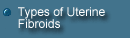 Types of uterine fibroids